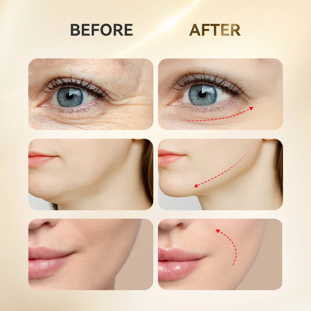 Facial Acupoint Massager