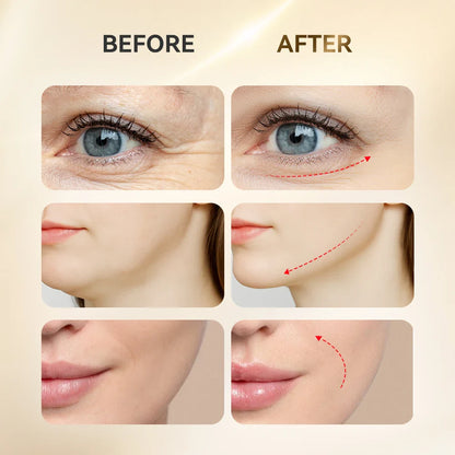 Masseur d'acupuncture facial